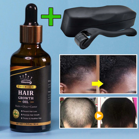 Shkorina Hair Growth Oil